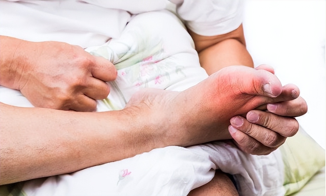 查出高尿酸这五件事再难也要坚持,高尿酸有五个表现症状图片