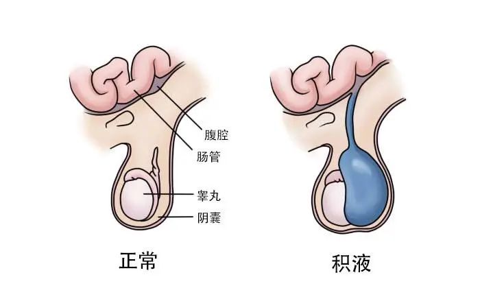 宝宝睾丸红肿应该去哪个科看,宝宝睾丸红肿医院消炎