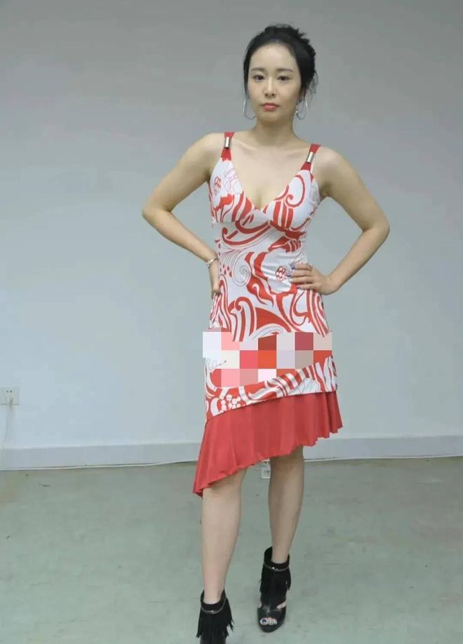 脸上有痘坑的明星,脸上爆痘特别多还好看的明星