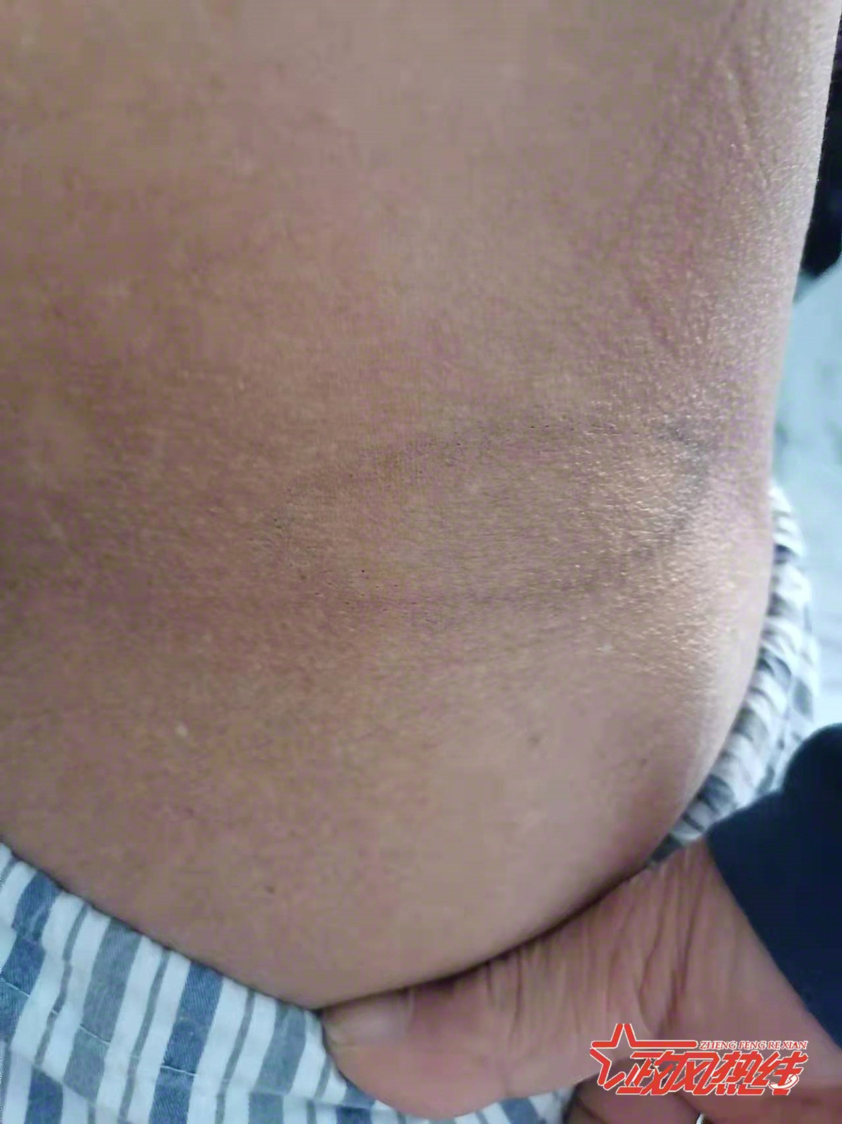 南京市第一医院做手术,南京选择医院做手术