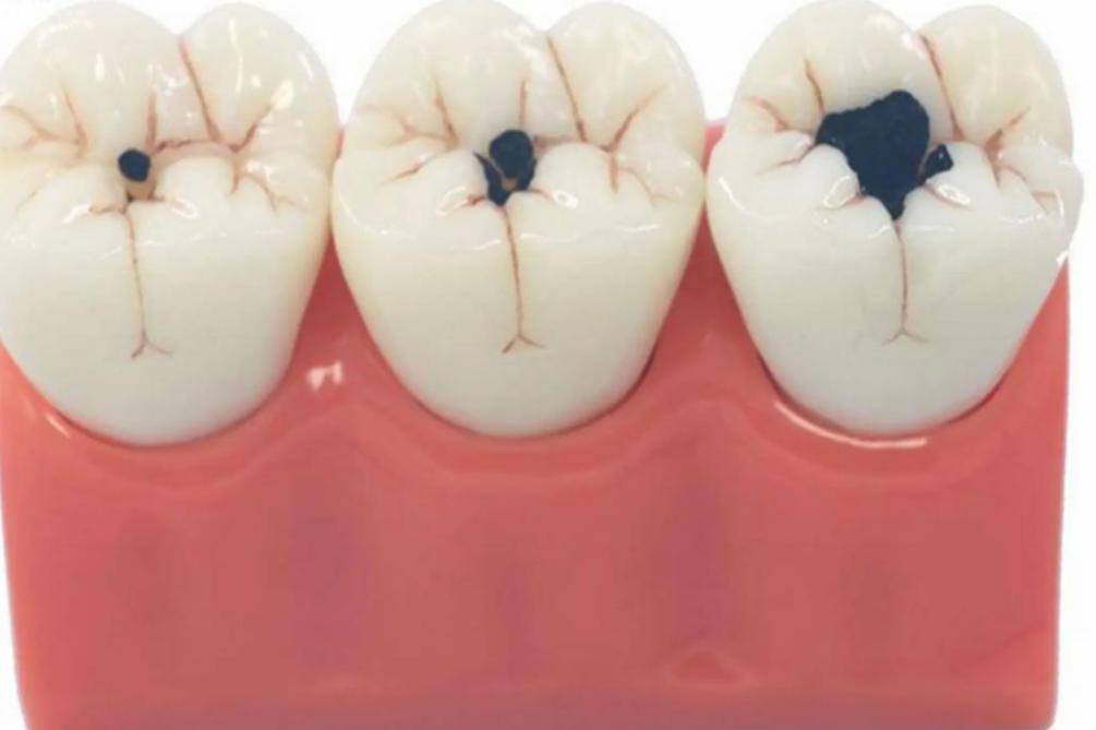 牙科恐惧症如何缓解,牙科焦虑症和牙科畏惧症