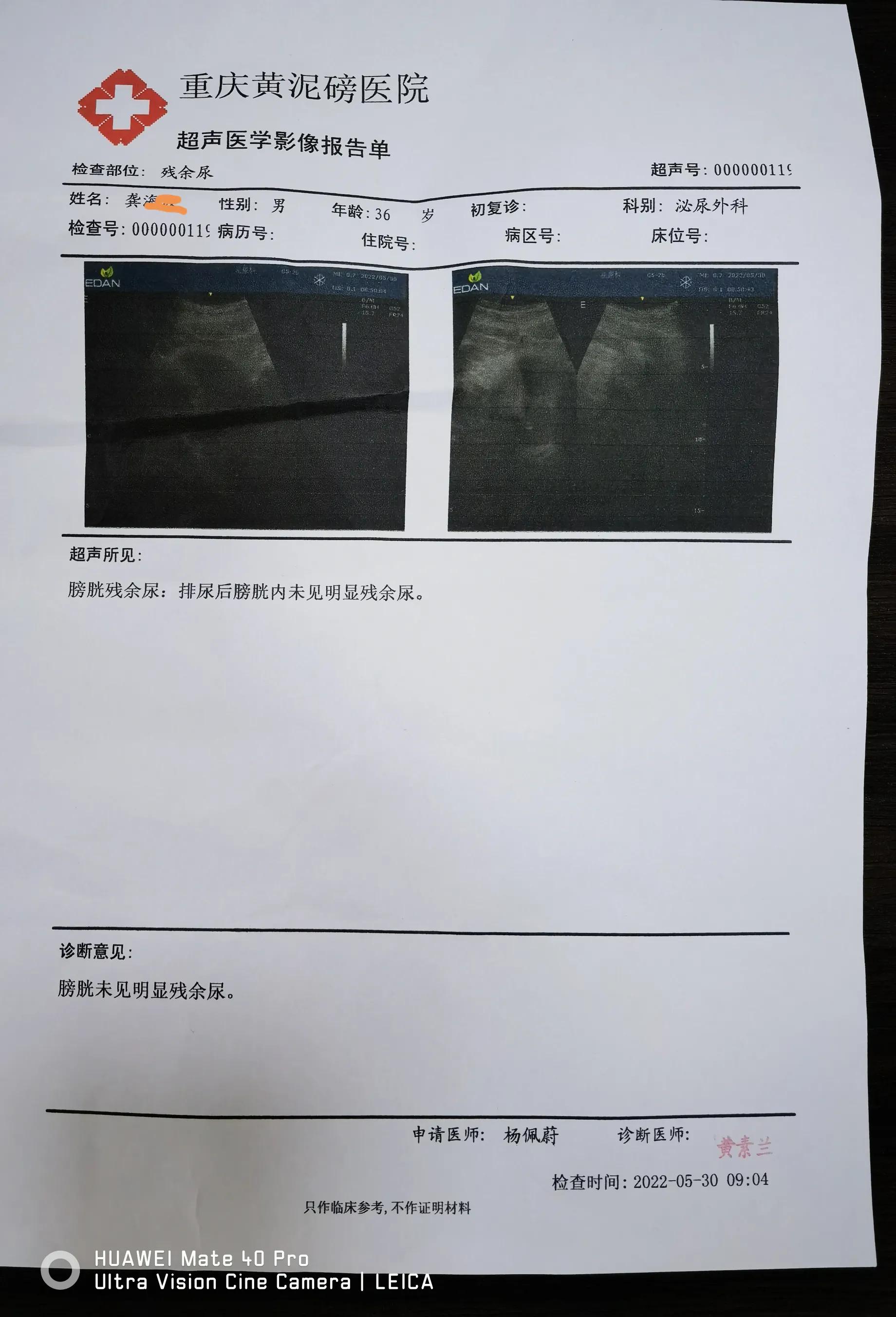 哪家医院能解决尿道狭窄问题,哪里可以治愈尿道狭窄