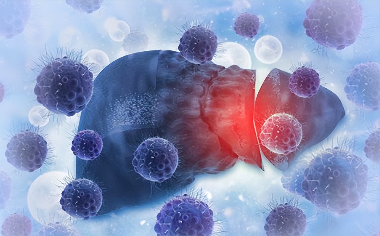 24岁女生确诊肝癌晚期崩溃,29岁护士突发疾病逝世