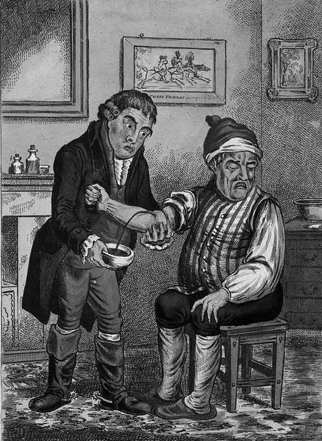 难以想象的“狗血”医学理论及治疗方法，盛行于中世纪的欧洲