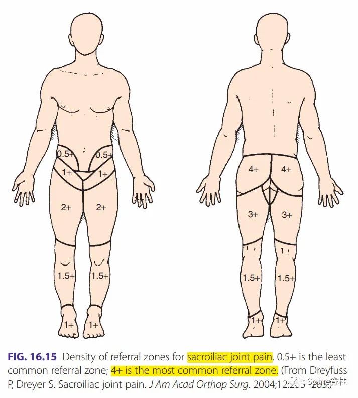 腰椎间盘突出症状表现,腰椎间盘突出症疼痛最佳止痛方法