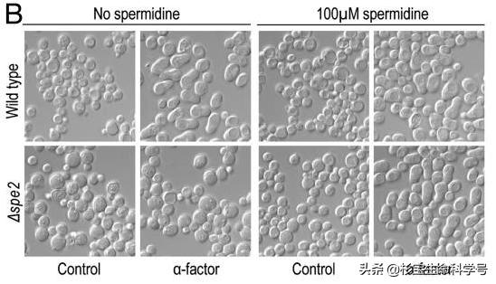 备孕强精的误区你中了几个,亚精胺对生成精子有用吗