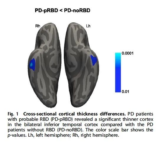 世界帕金森病日第28个主题,世界帕金森病日完整版