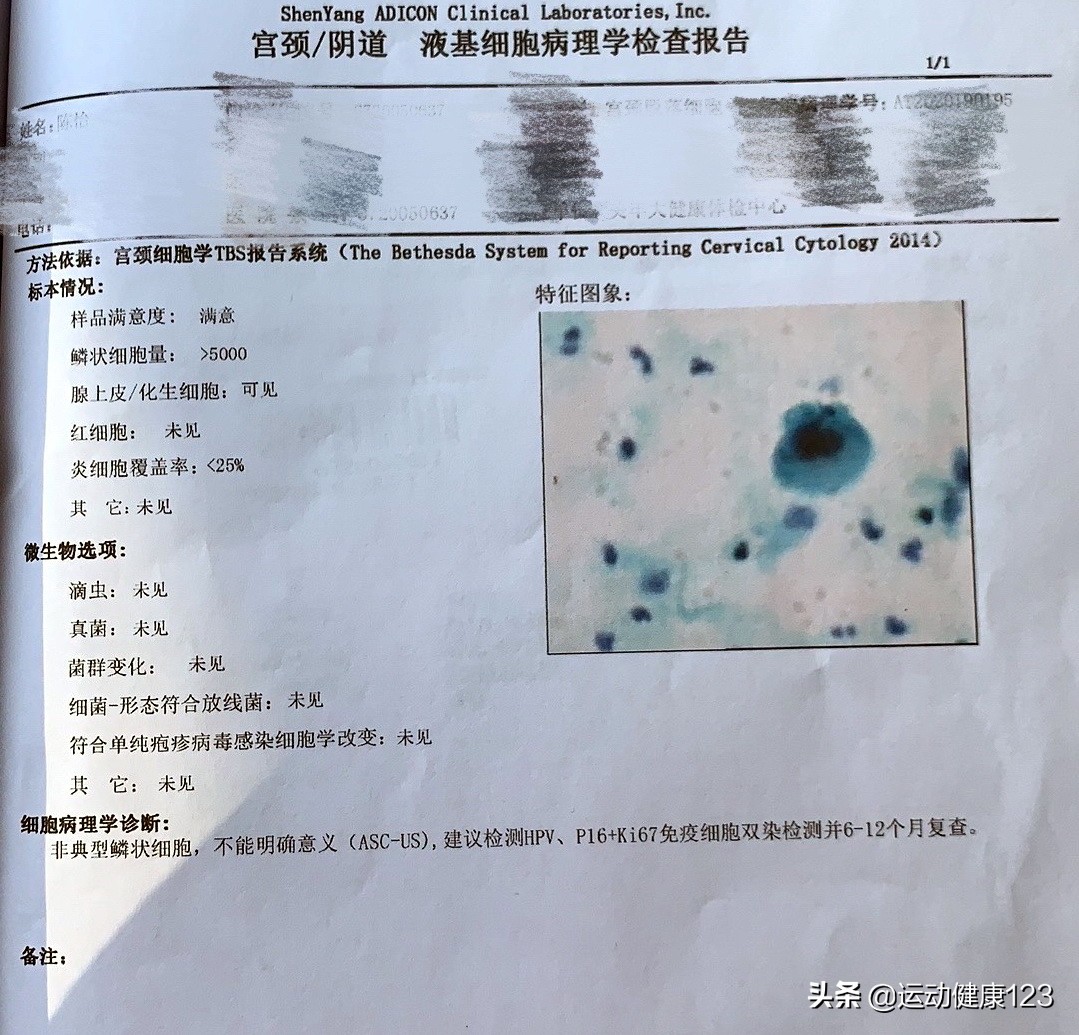 宫颈癌占女性恶性肿瘤第几位,恶性肿瘤早期唯一症状