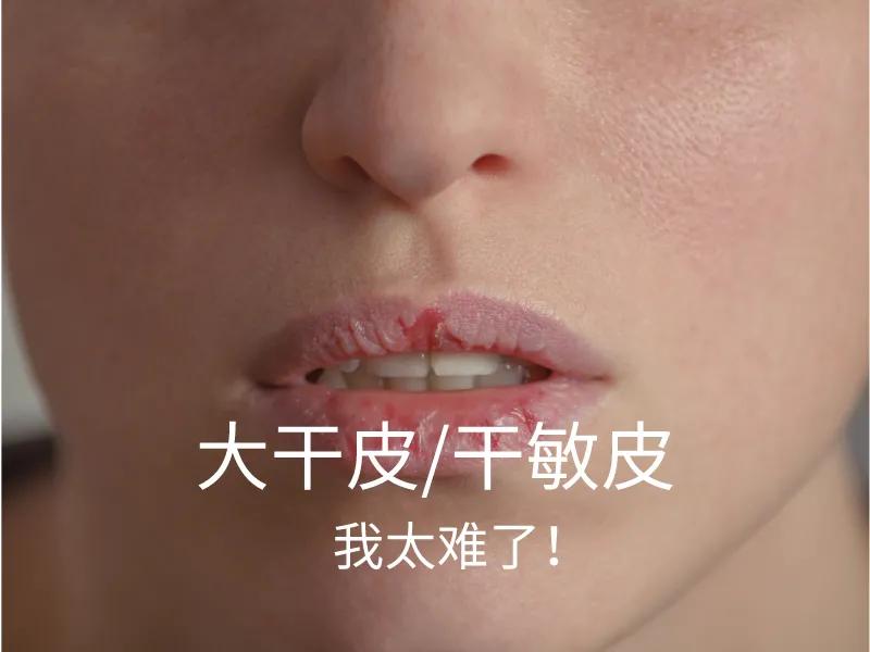 雅漾敏感肌修复屏障护肤品前十名,雅漾敏感肌值得买的