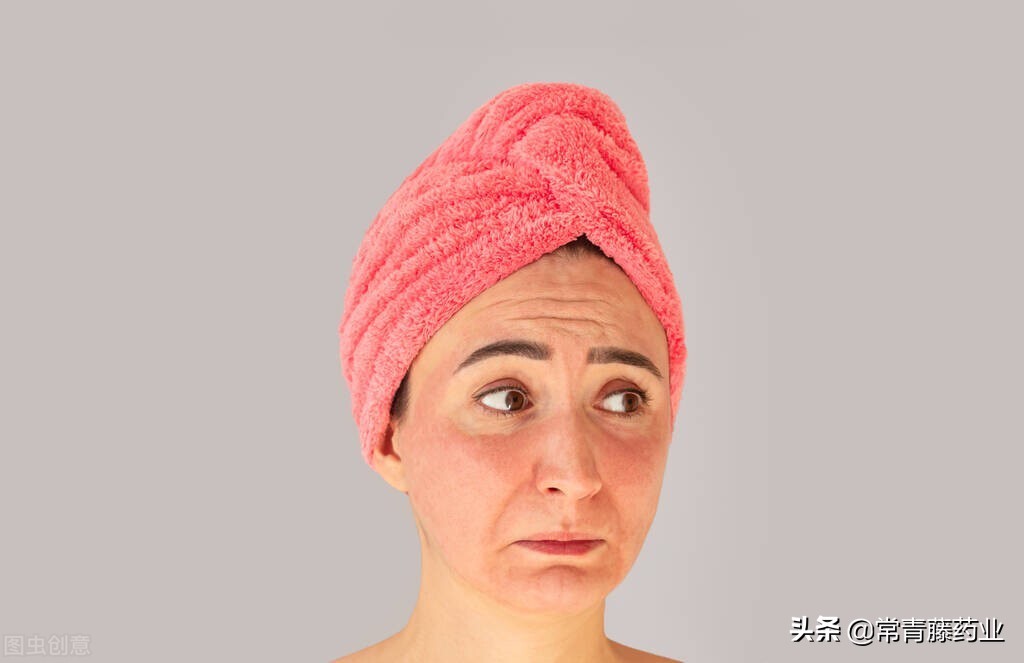 如何分辨晒斑色斑,晒斑与黄褐斑雀斑的区别