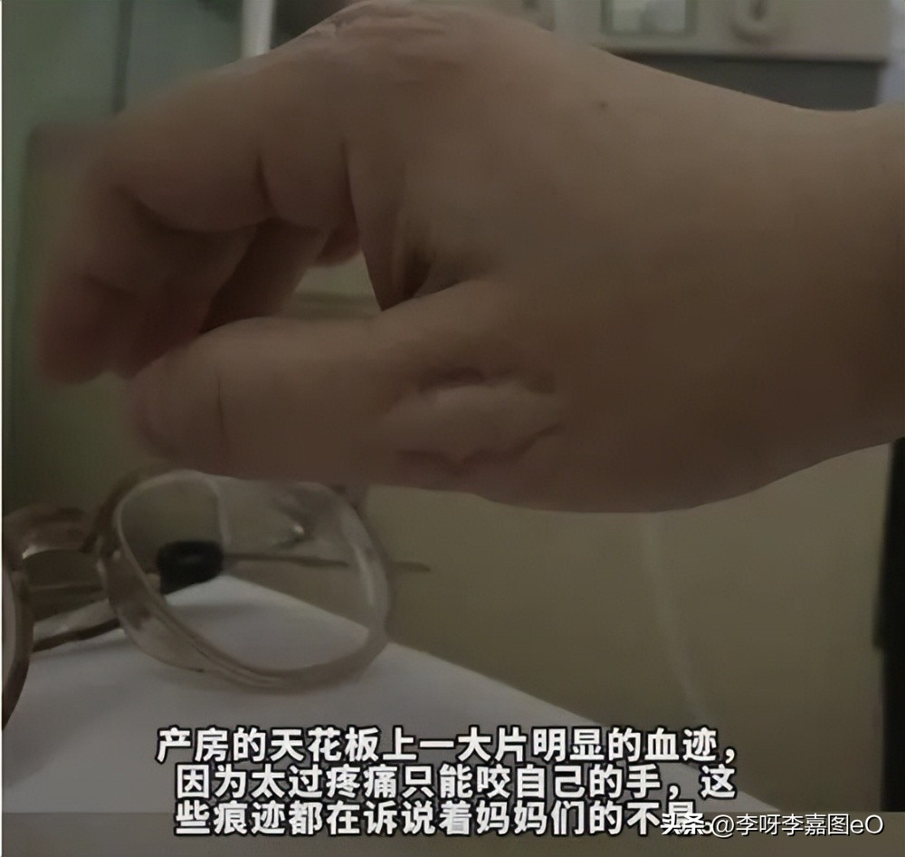 产妇拍下产床抓痕引20万妈妈共鸣:“生孩子我至今想起都心颤”