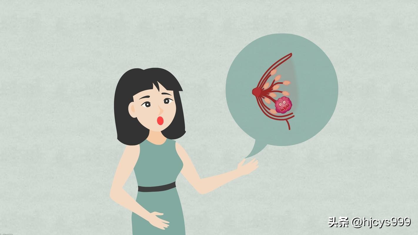 乳腺囊肿甲状腺囊肿子宫肌瘤,甲状腺结节与子宫肌瘤同时存在