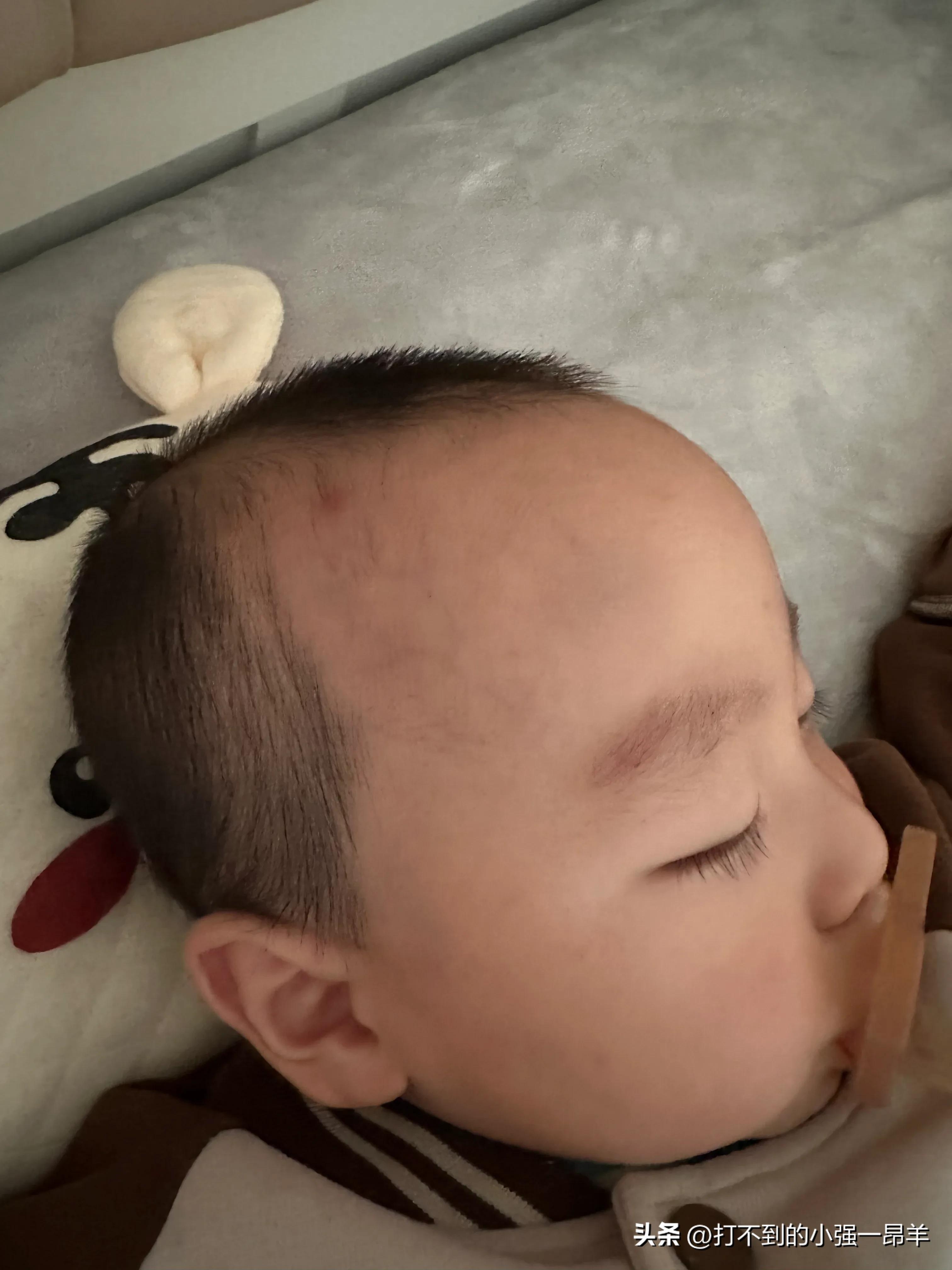 宝宝摔到头一直不好怎么办,宝宝摔到头了可以用什么药