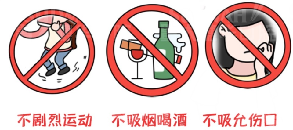 拔了下颚智齿后有个洞堆积残渣,智齿上面有个洞是补还是拔了好