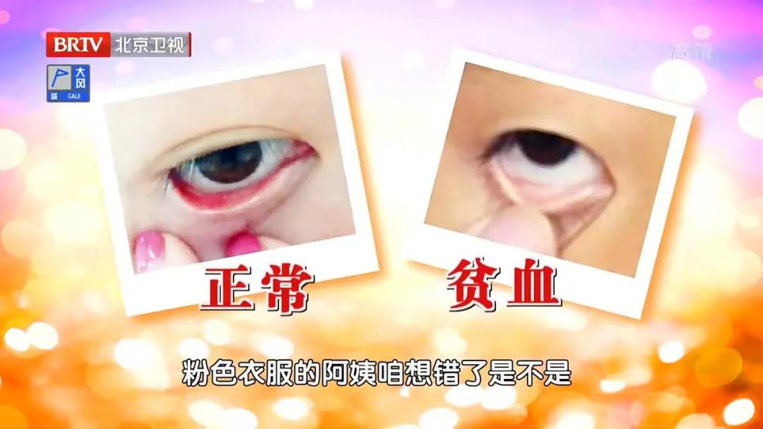 走路不稳警惕四种病,睡觉出现4个异常需警惕脑梗