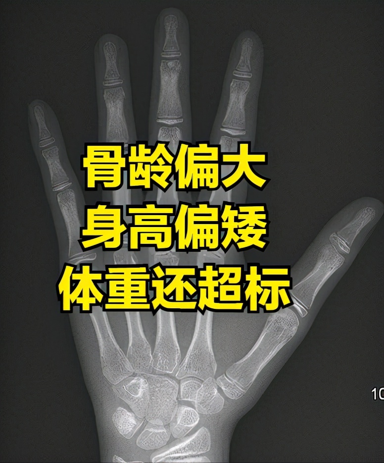 孩子身高偏矮6个干预方案,孩子身高偏矮怎么干预