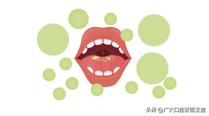 清晨起来嘴发苦是怎么回事,早晨起来嘴发苦怎么分辨是什么病