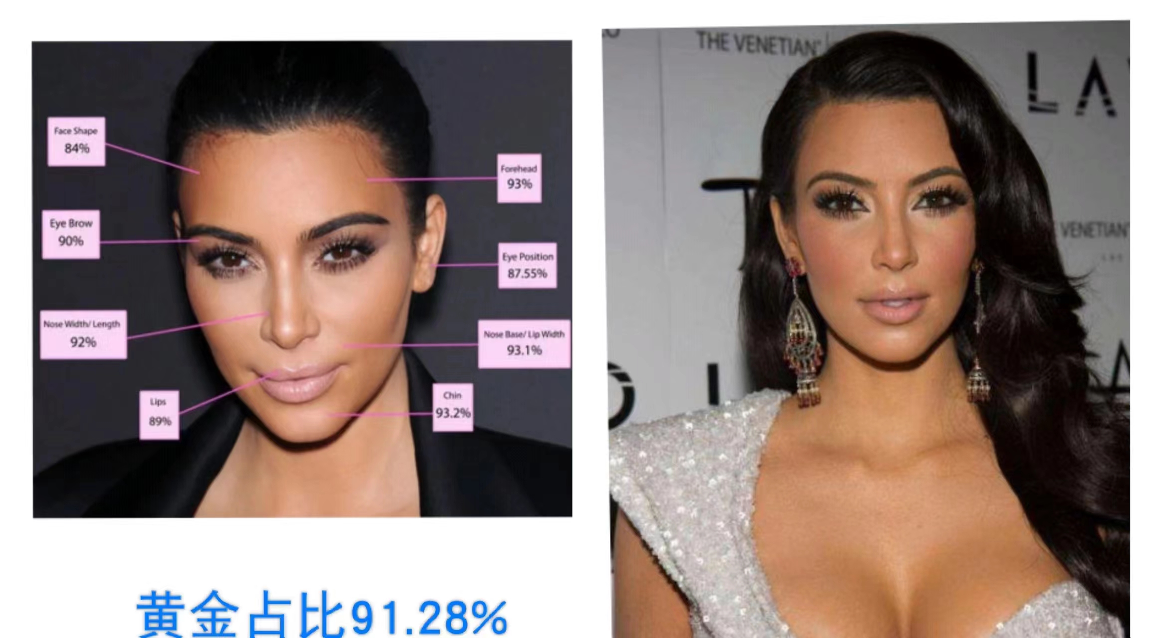 血压高的女明星,血压超高女士