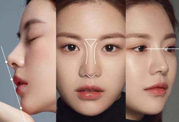 初鼻如何选择隆鼻,鼻基础好做隆鼻要多久