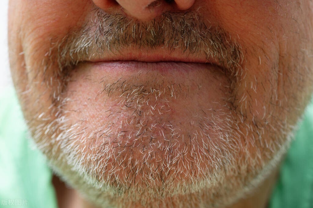 为什么头发眉毛都是直的，阴毛却是卷的？医生给出了明确答案