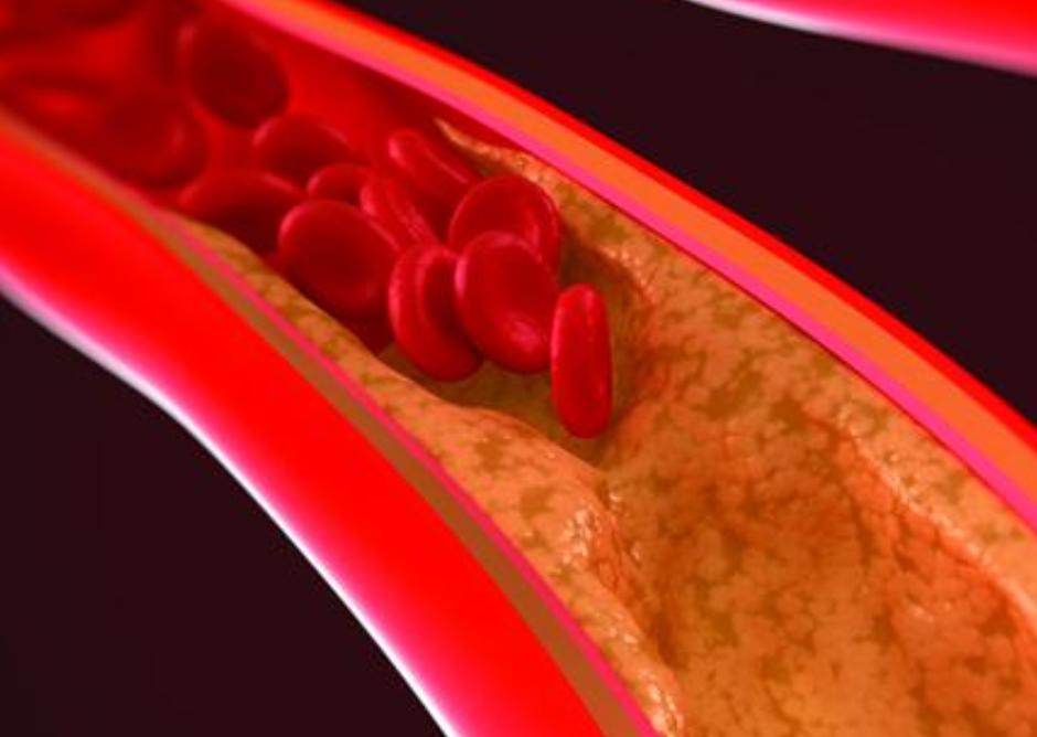 中医学的五脏学说肺,在中医五行中哪种原则是入肺的