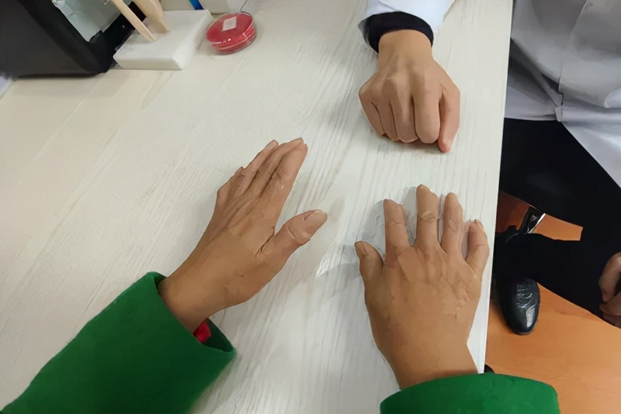 怎样治疗类风湿性关节炎,治疗类风湿性关节炎最先进的方法