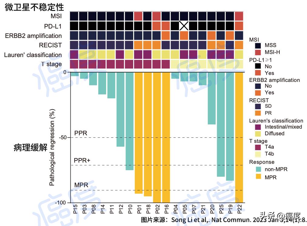 局部晚期胃癌有可能治愈吗？