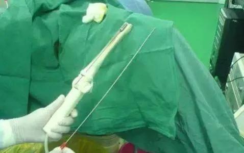 *市黑**卖卵，非法代孕，不打麻药穿刺下身：女大学生要小心卖卵*局骗**