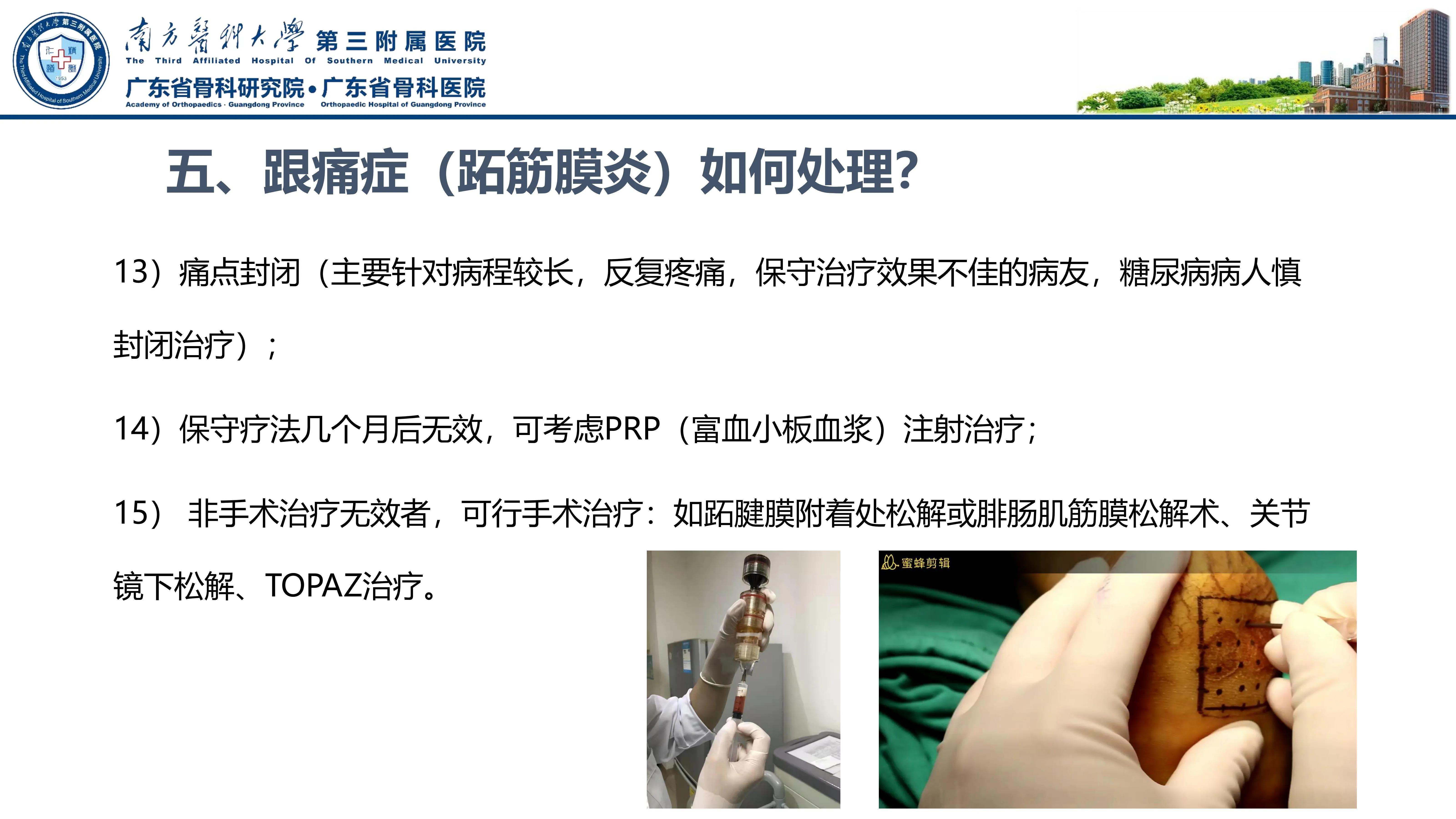 足底筋膜炎和跖痛症一样吗,足底筋膜炎和足痛的处理方法