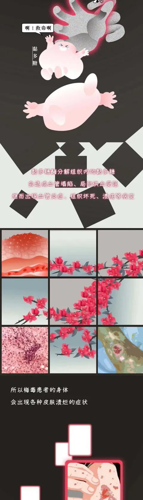 梅毒来历,梅毒真的那么可怕吗漫画