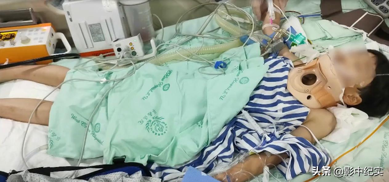 十岁的男孩开卡丁车追尾,10岁男孩玩卡丁车拦腰截瘫