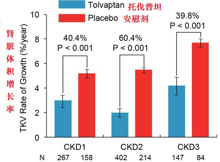 一家接连患尿毒症，是怎么回事？了解最常见的遗传性肾病-多囊肾