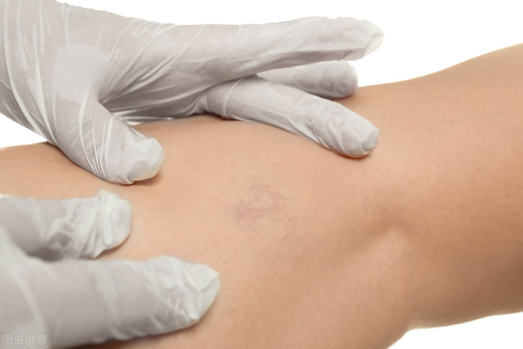 急性肝炎中医名称,急性肝炎中医治疗方法