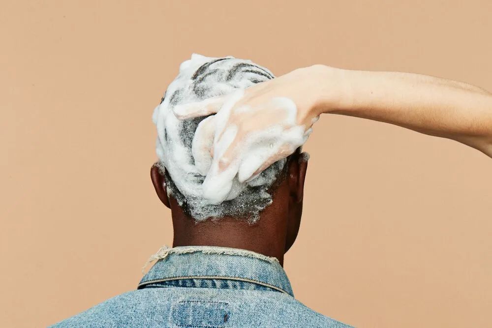 植发生意为何火爆,暴利的雍禾植发