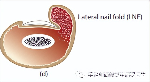 宝宝脚趾甲有脓了怎么处理,给宝宝剪指甲流脓怎么办