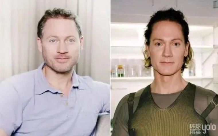 硅谷大佬重返18岁失败了吗,硅谷大佬返老还童