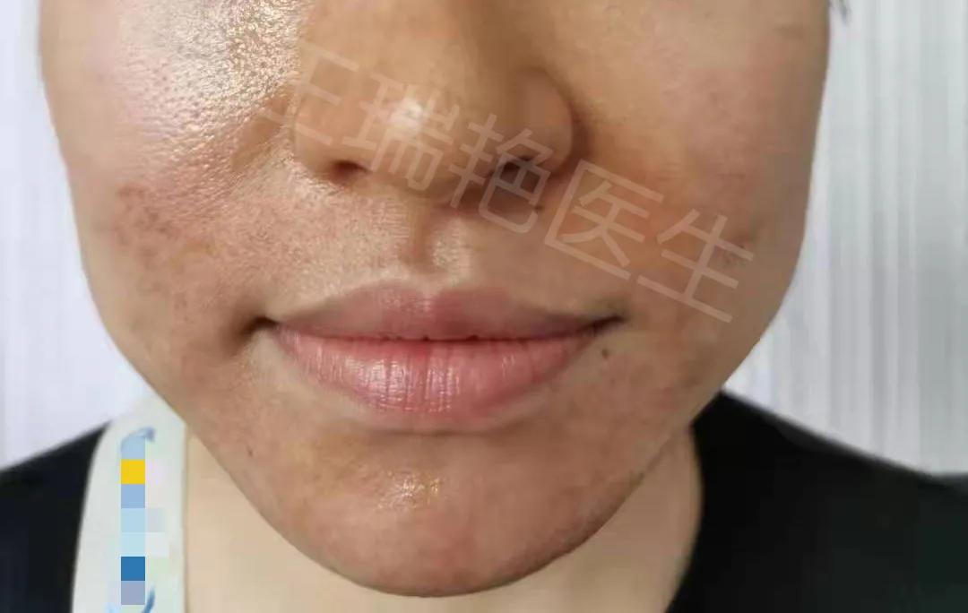 代购护肤品卖假货怎么办,代购购买的护肤品破损了