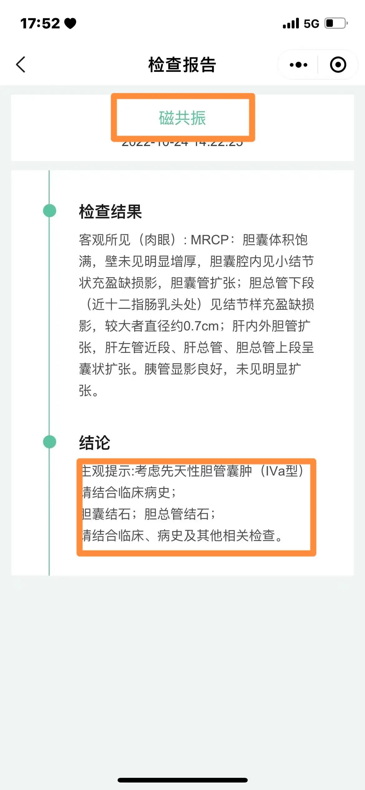 上火会导致尿液发黄吗,小便发黄是身体里排毒吗