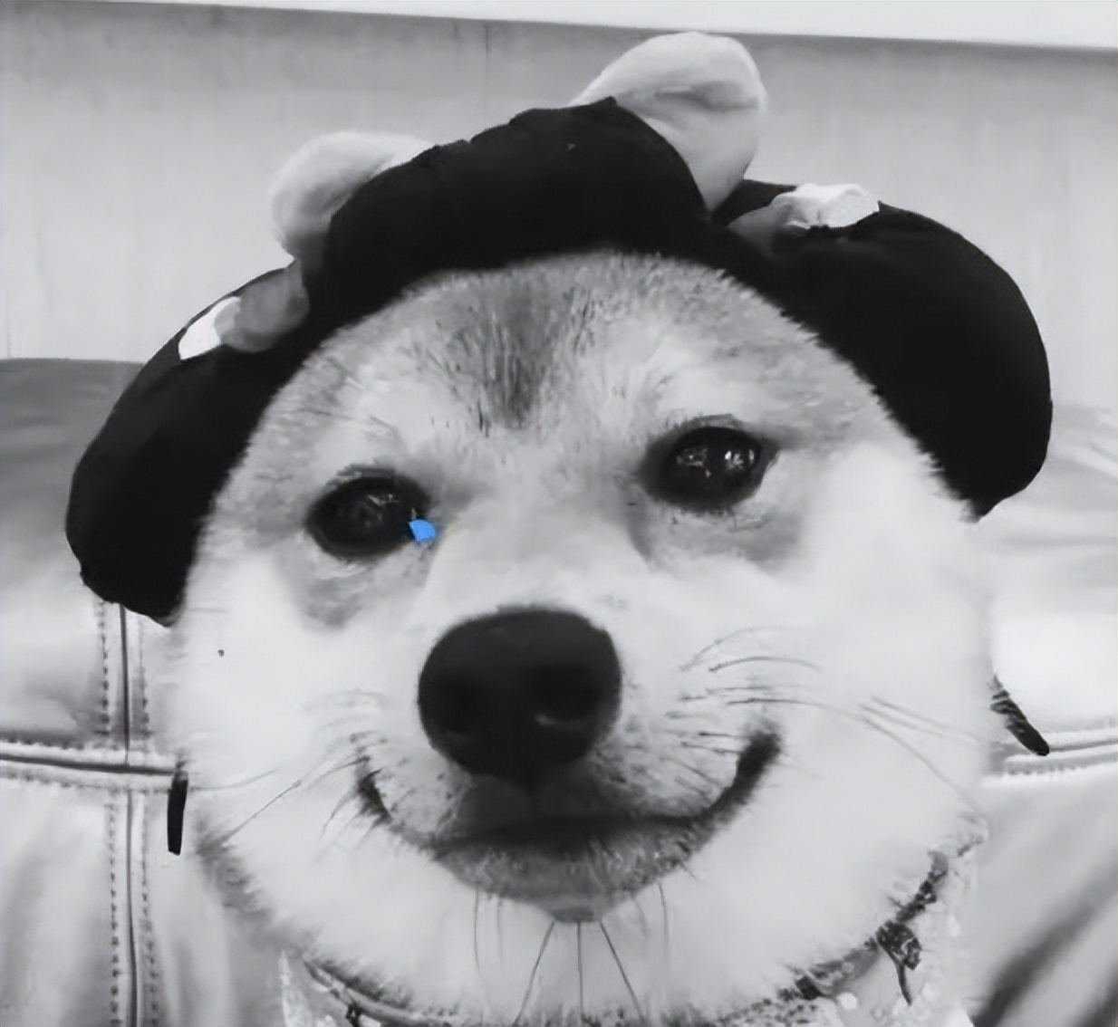 脂溢性皮炎最怕的克星,治疗脂溢性皮炎处理视频