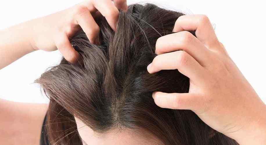 治疗头屑脱发最有效的办法,头屑头痒脱发治疗方法