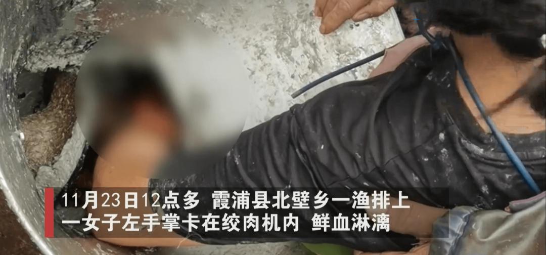 女子绞肉时手指被卡,工人手卡绞肉机血流不止