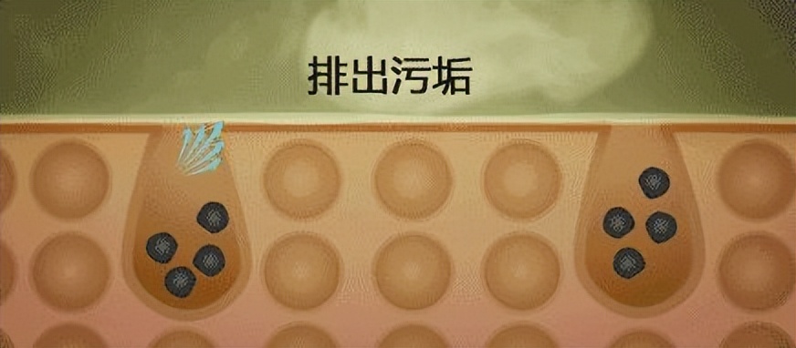 毛孔粗大的正确护肤步骤是什么,毛孔粗大护肤的正确步骤图