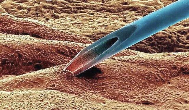 显微镜观察人体的四种组织图片,人体显微镜下的样子