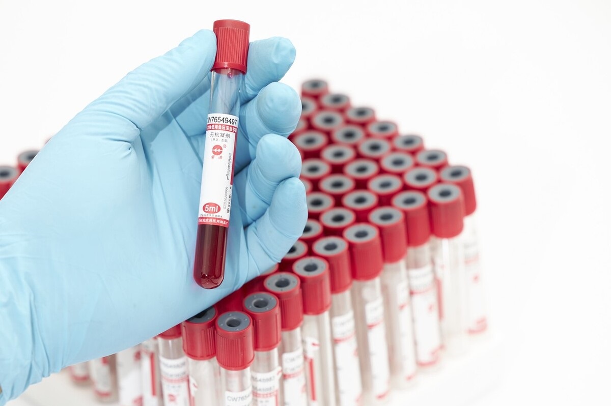 老年人直接胆红素偏高要注意什么,三项胆红素都偏高平时应注意什么