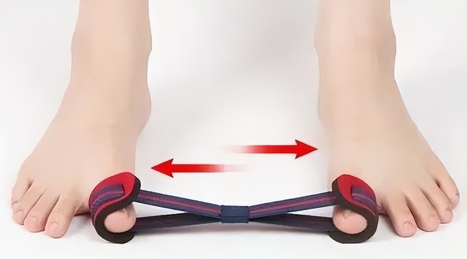 拇外翻的5种解决方法,拇外翻做什么动作缓解