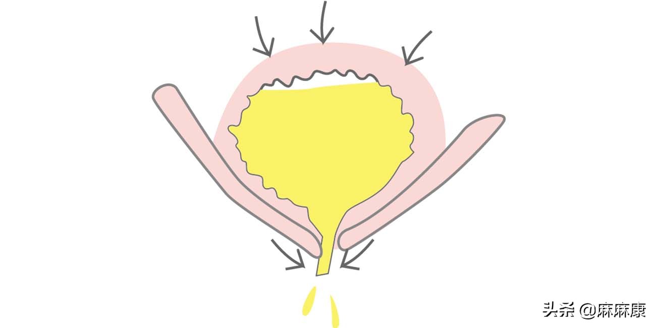 母牛产后排尿困难怎么回事,产后插尿管2次还是排尿困难