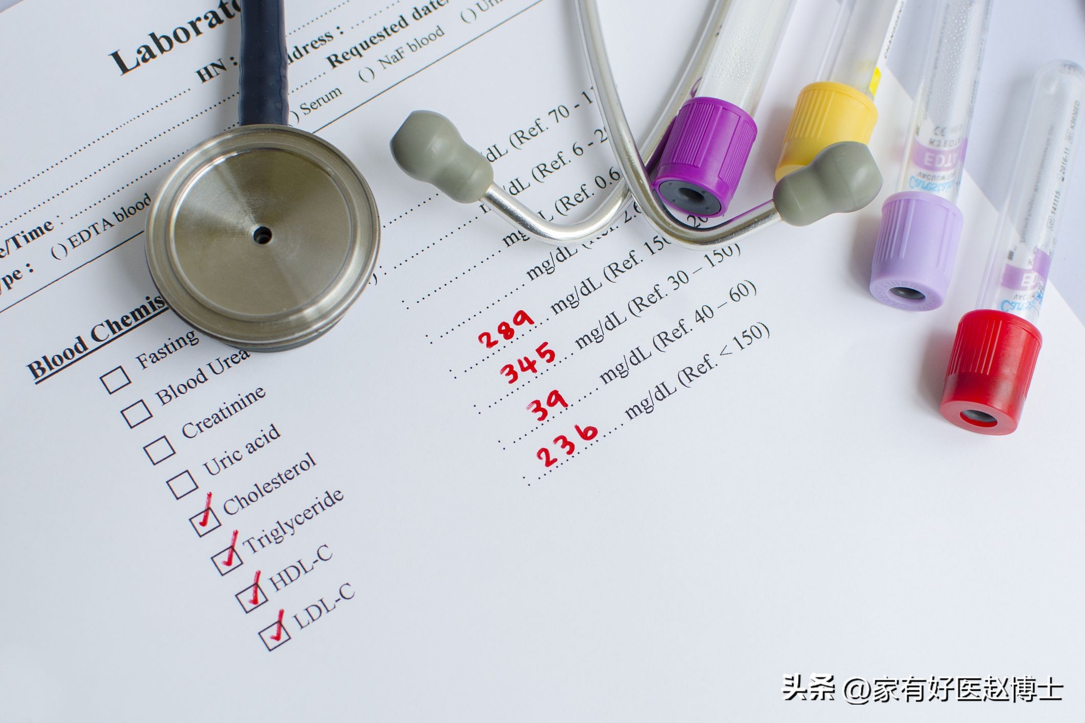 总胆固醇高，但低密度不高，要吃他汀吗？警惕这项“隐藏”指标！