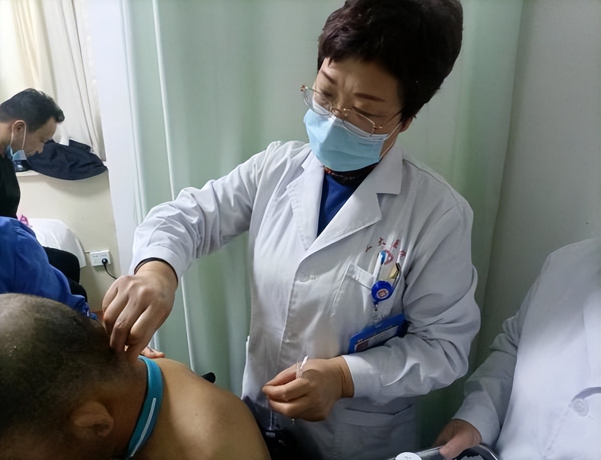 山西省中医院特色疗法焦氏头针,康复针刺运动疗法