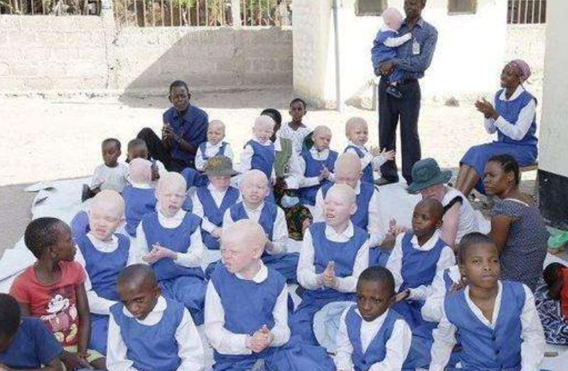 非洲最特殊的人群：血液堪比黄金，遗骸卖上百万，却无法健康成长