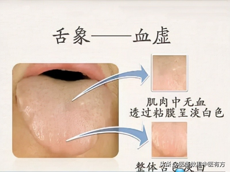 温经汤治月经不调痛经,妇科祖方温经汤